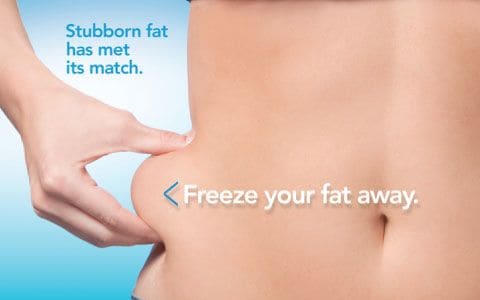 Hips treatment Broxburn From Lipo Sculpt