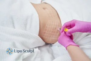 Do you want to know how long Aqualyx Broxburn results last?