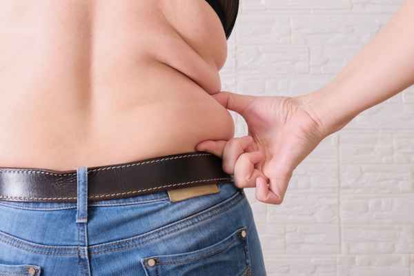 back fat reduction Broxburn from Lipo sculpt find the best option for you!