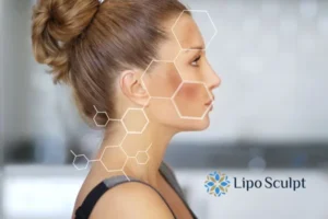 Are you looking at age spots Broxburn removal? Contact Lipo Sculpt today!