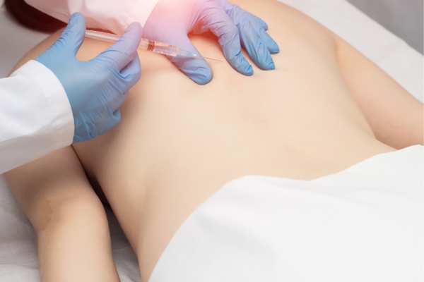 Lipo Sculpt will offer the best fat back reduction Broxburn call us today!