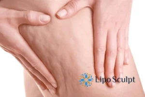 Start your journey today book your coolsculpting treatment Broxburn online today!